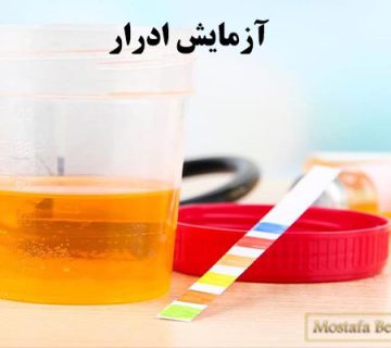 آزمایش ادرار