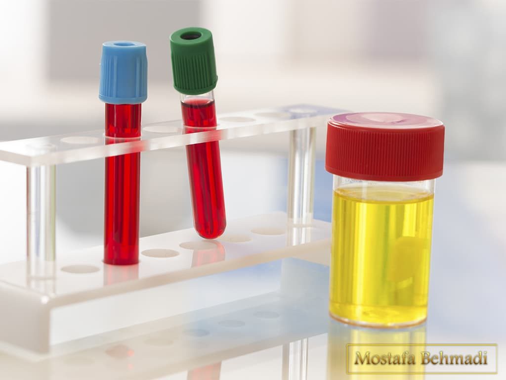 تفسیر آزمایش کشت ادرار