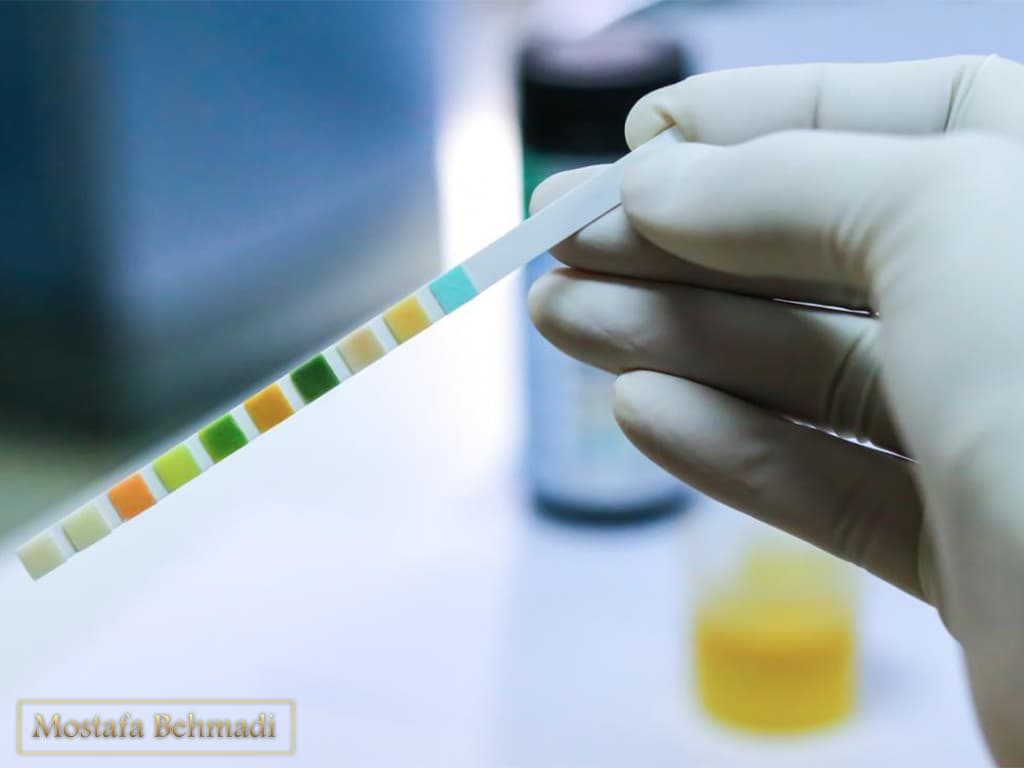 آزمایش کشت ادرار آزمایش کشت ادرار