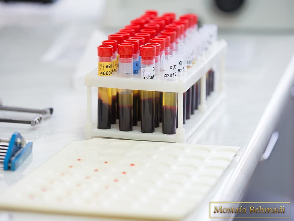 تفسیر جواب آزمایش