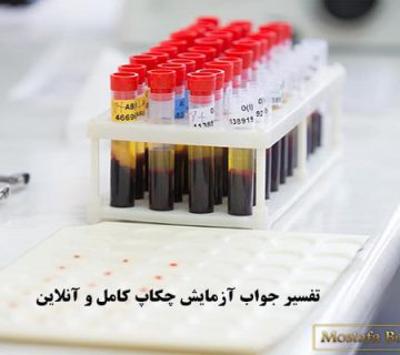 تفسیر جواب آزمایش چکاپ کامل و آنلاین