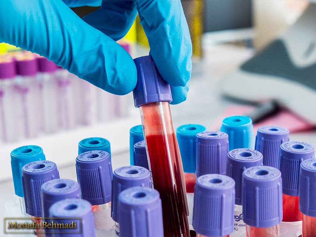 خون شناسی خون شناسی