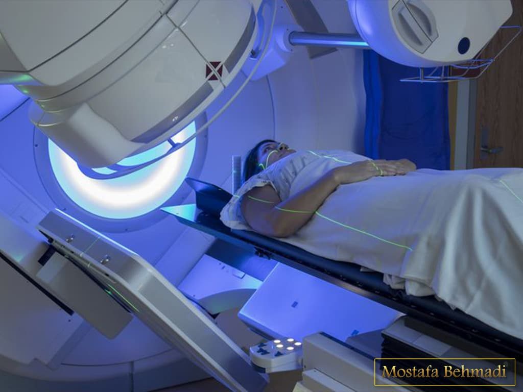 پرتو درمانی پرتو درمانی