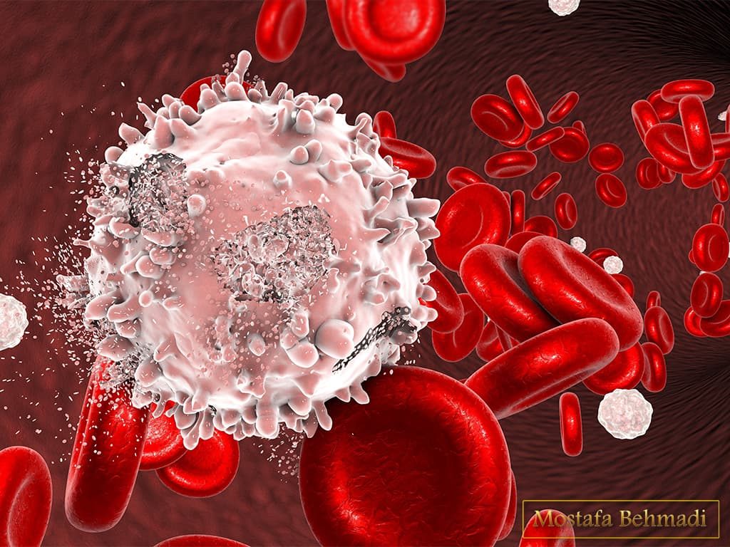 سرطان خون ، علائم و انواع آن ، پیشگیری و درمان سرطان خون ، علائم و انواع آن ، پیشگیری و درمان