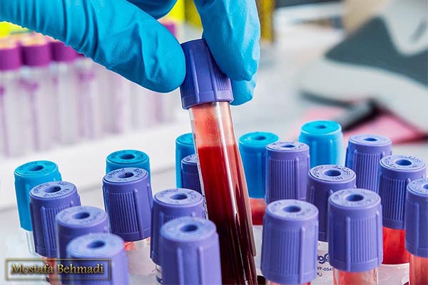 علائم اختصاری آزمایش خون