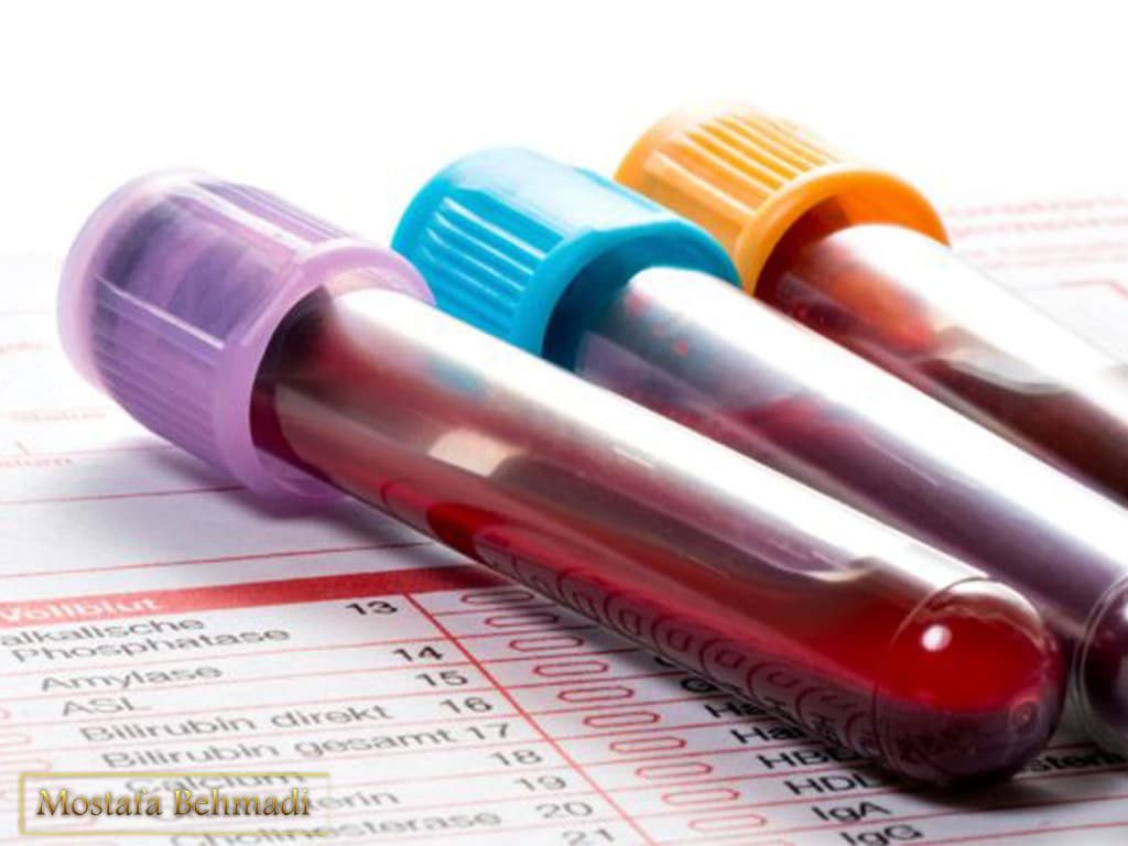 تفسیر آزمایش خون