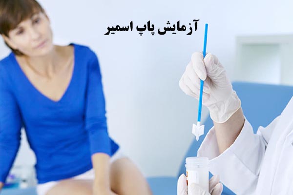 آزمایش پاپ اسمیر