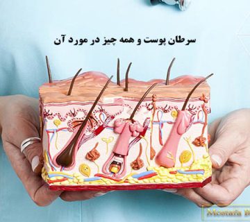 سرطان پوست و همه چیز در مورد آن