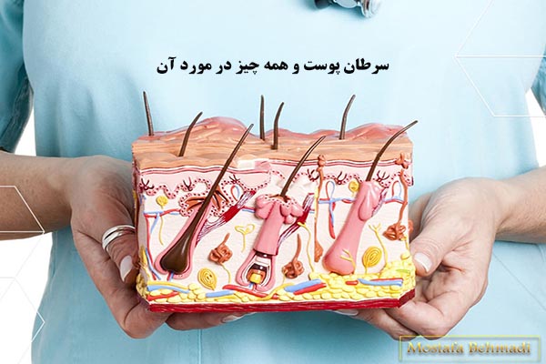 سرطان پوست و همه چیز در مورد آن