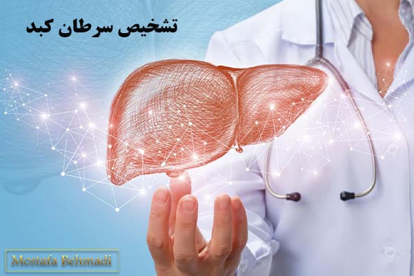 سرطان کبد و همه چیز در مورد آن