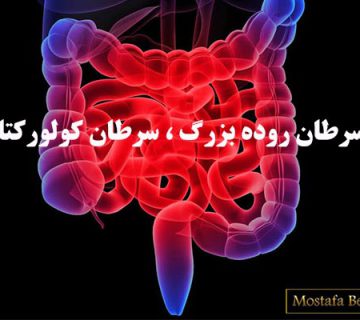 سرطان روده بزرگ ، سرطان کولورکتال