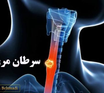 سرطان مری ، همه چیز در مورد آن
