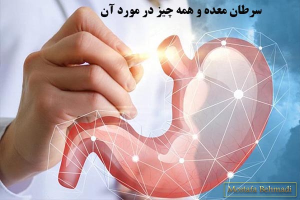 سرطان معده و همه چیز در مورد آن
