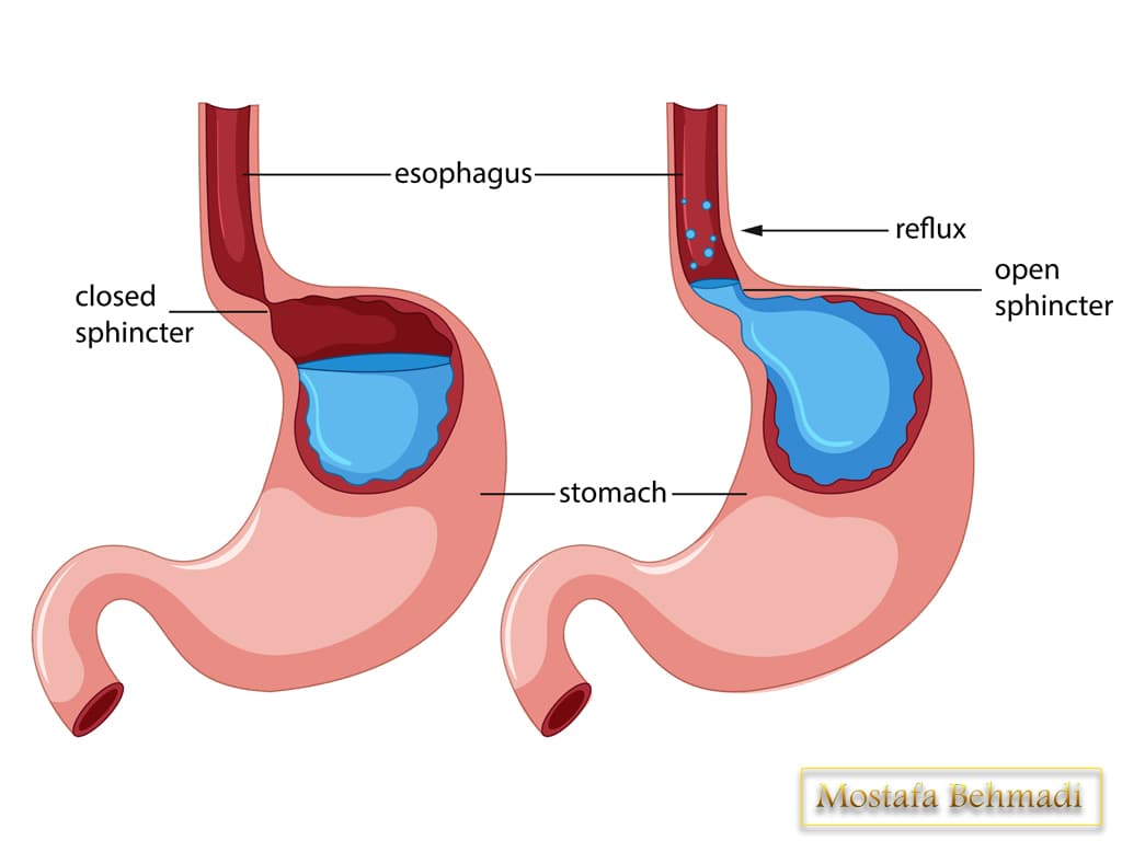 بخش های مختلف معده بخش های مختلف معده