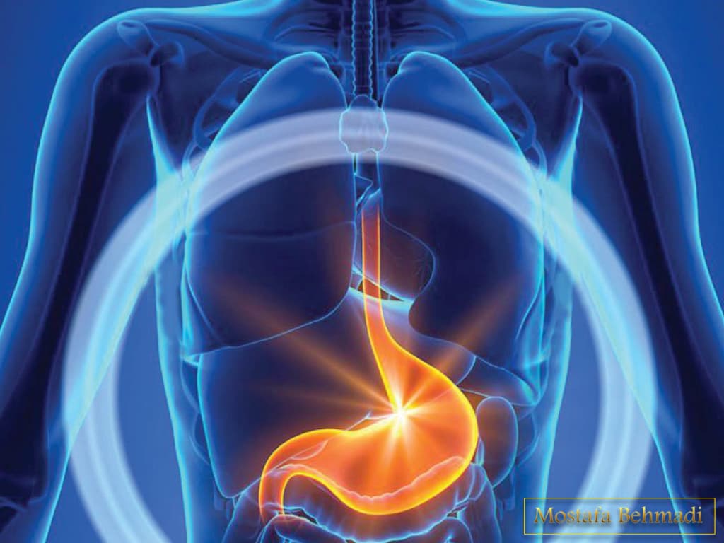 درمان سرطان معده درمان سرطان معده