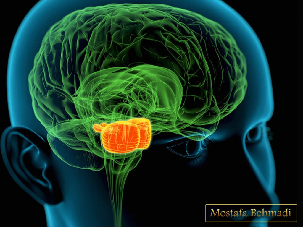 تومور مغزی تومور مغزی