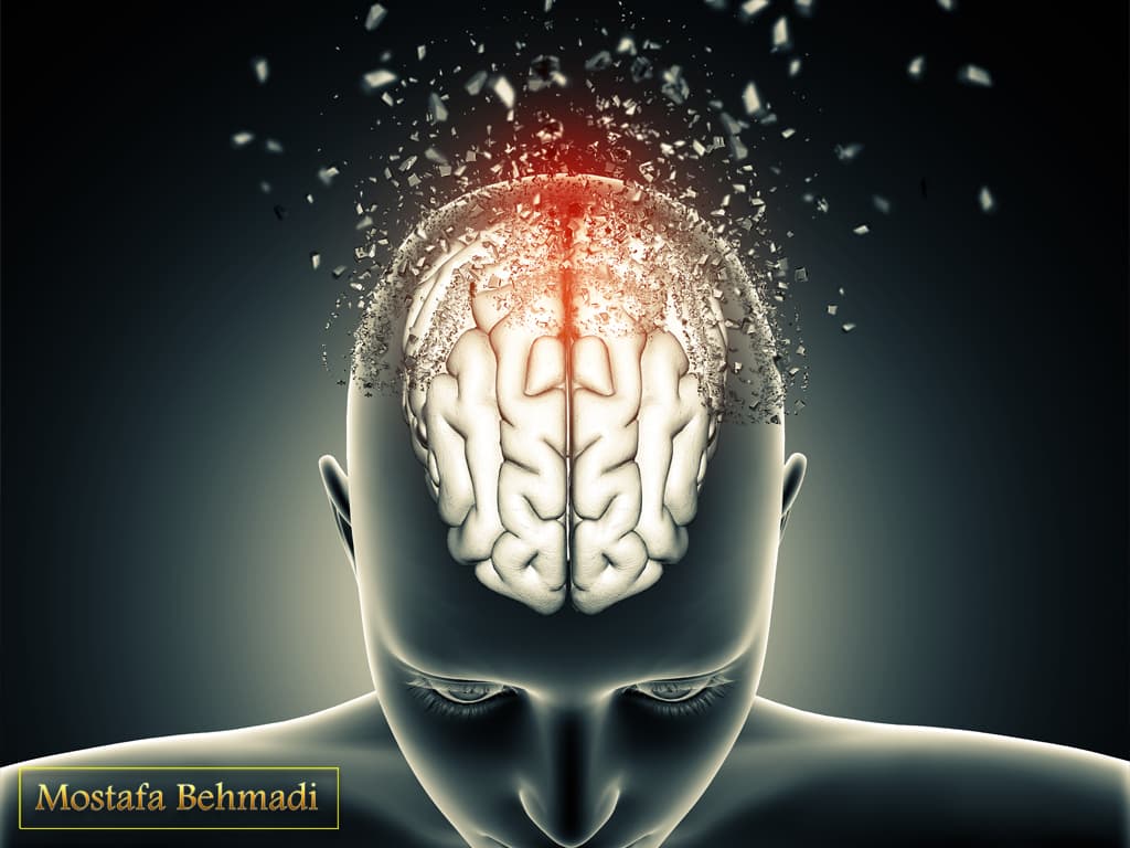 درمان تومور مغزی درمان تومور مغزی