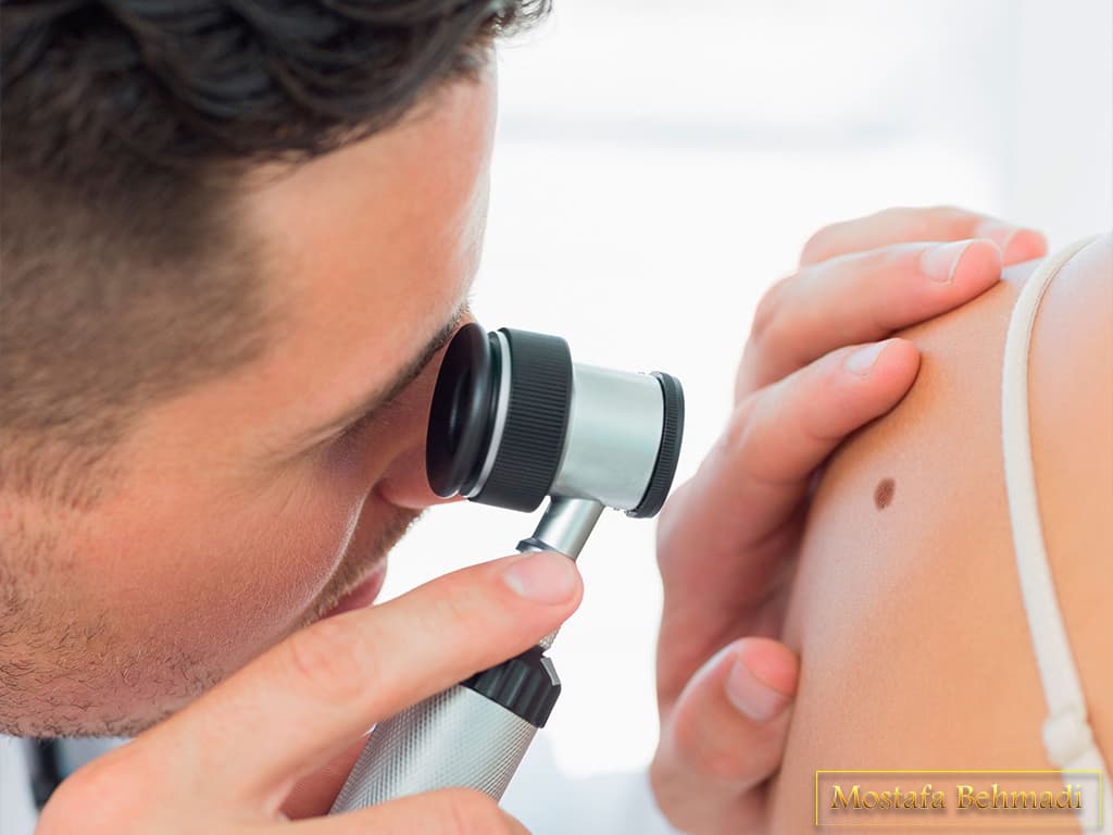 سرطان پوست و همه چیز در مورد آن