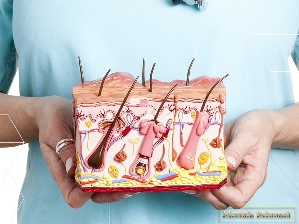 درمان ملانوما