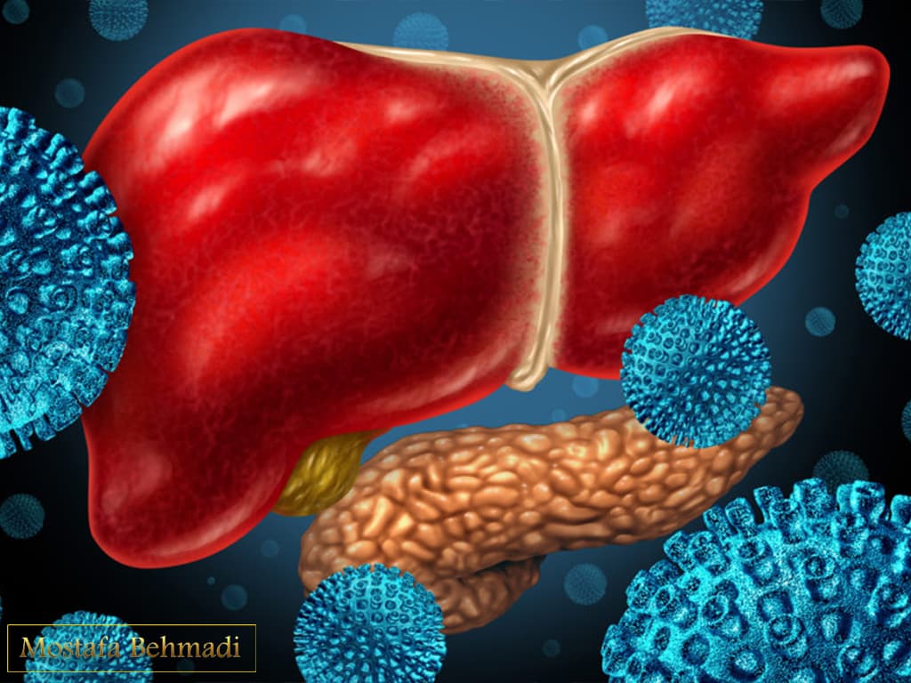 سرطان کبد از طریق ویروس سرطان کبد از طریق ویروس