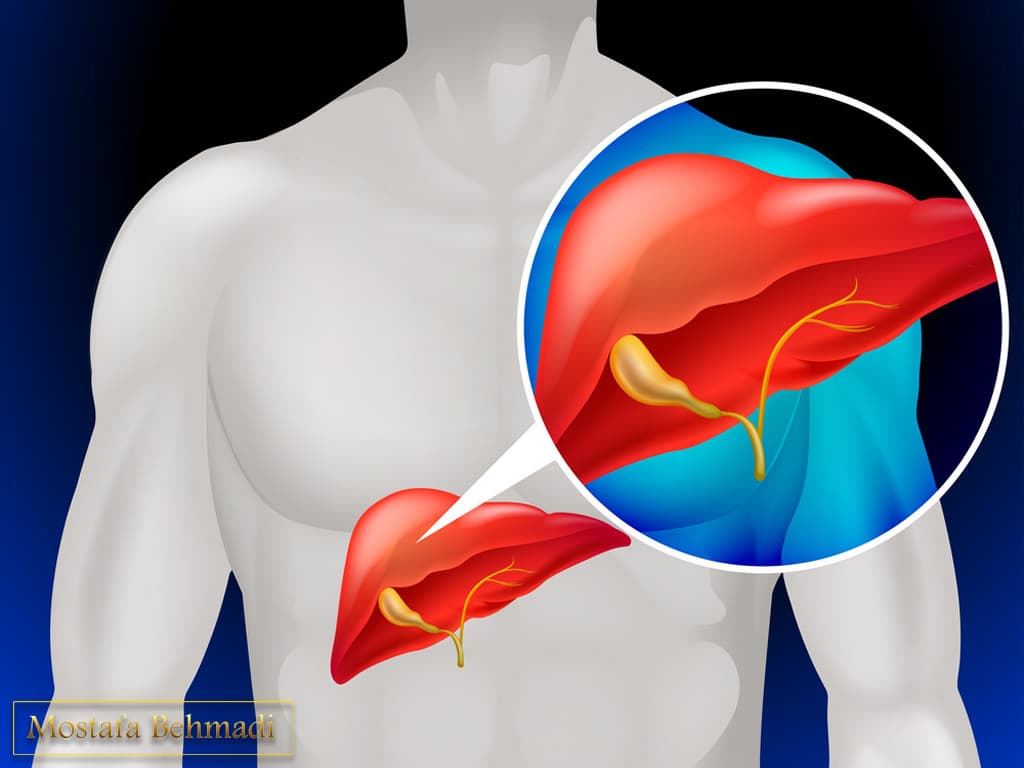 شیمی درمانی سرطان کبد شیمی درمانی سرطان کبد