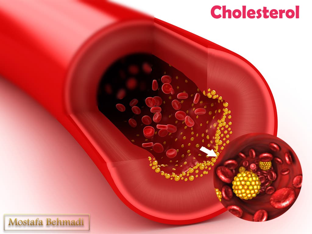 کلسترول - چربی خون
