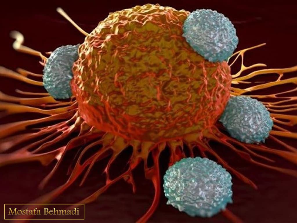 علائم سرطان خون اولین علائم سرطان خون