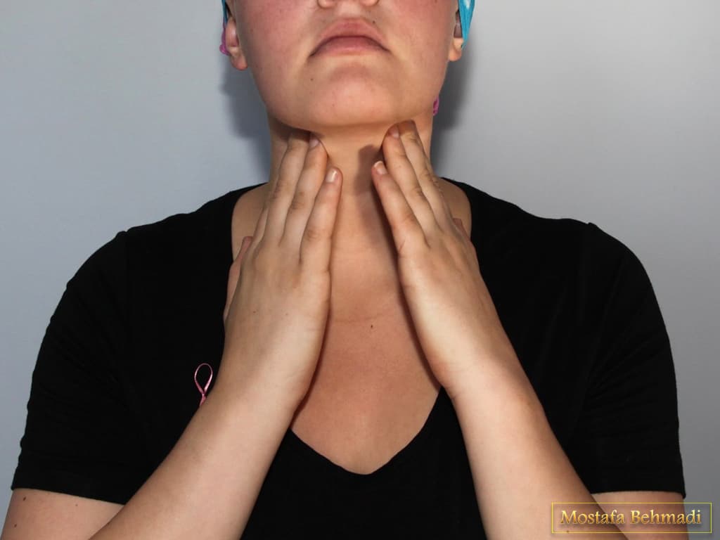نشانه های سرطان تیروئید