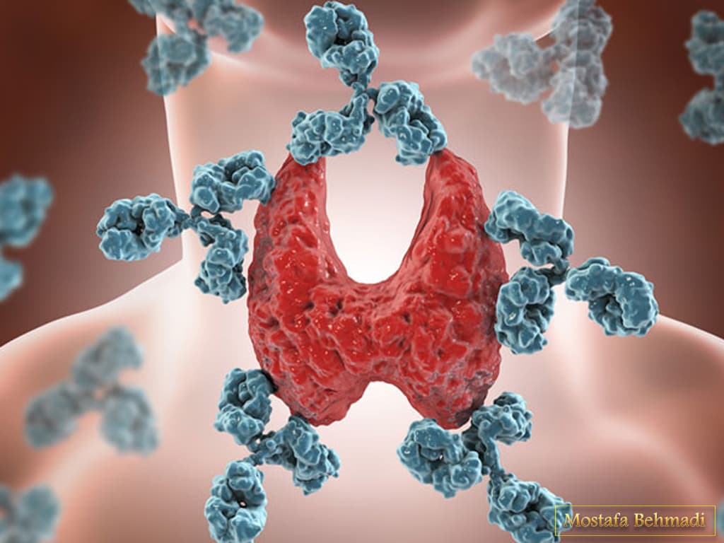 راه های تشخیص سرطان تیروئید