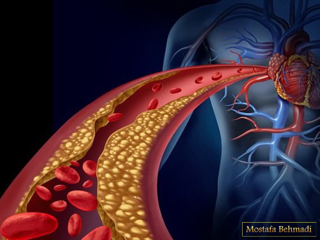 نشانه های سرطان خون نشانه های سرطان خون