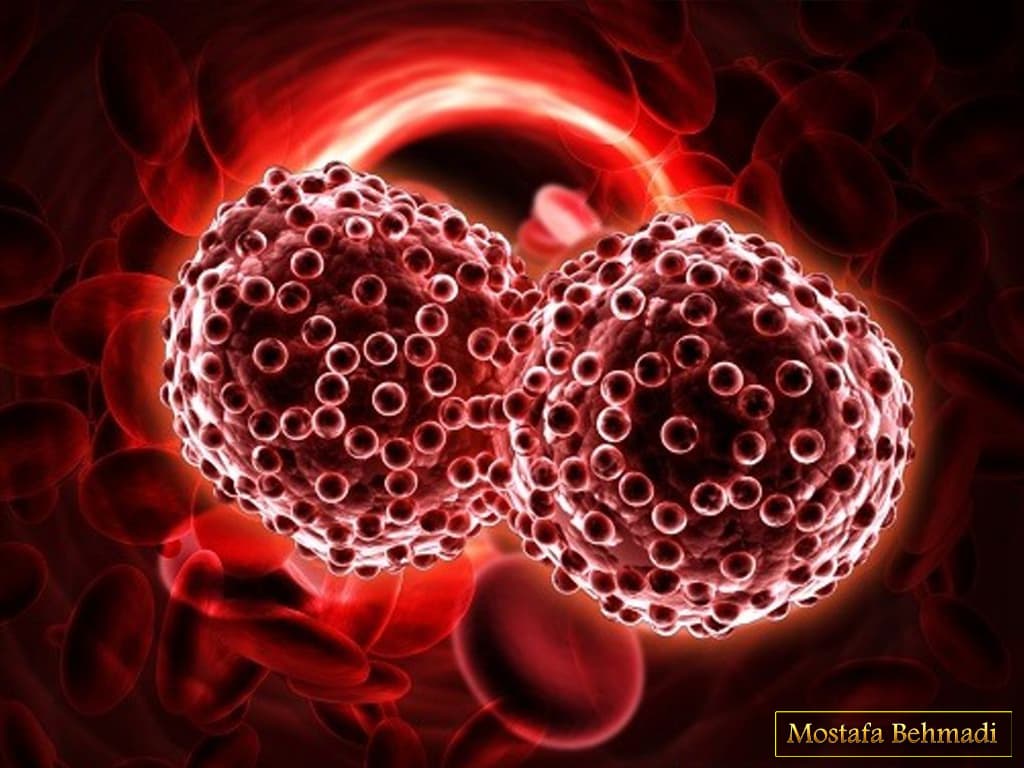 نشانه های سرطان خون لوسمی