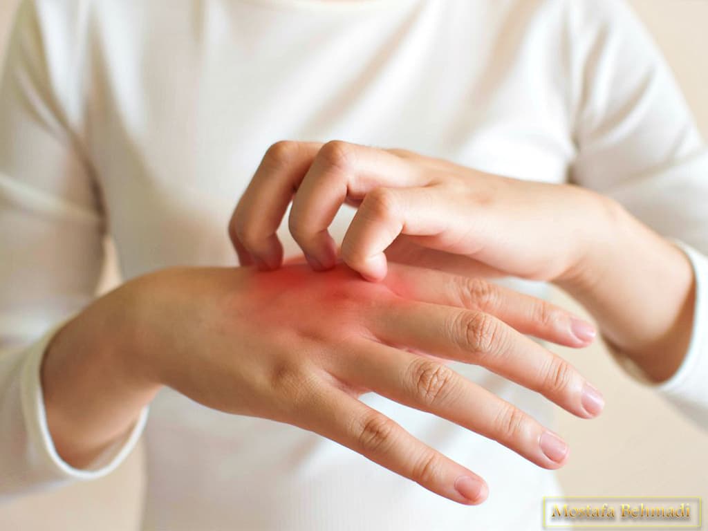 درمان سرطان پوست