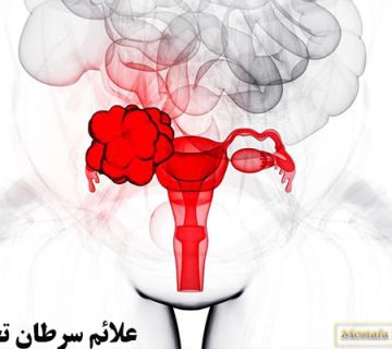 علائم سرطان تخمدان