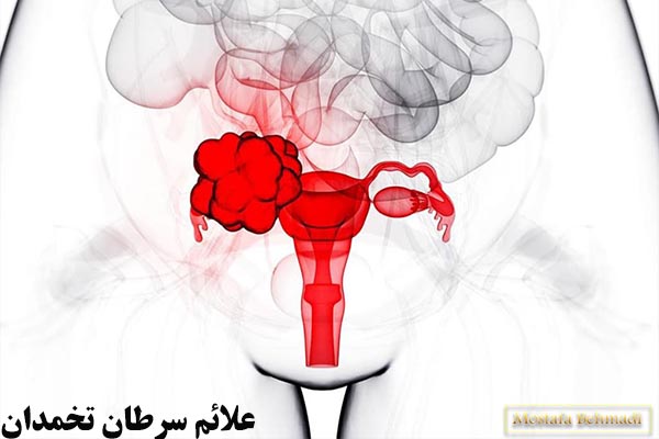 علائم سرطان تخمدان