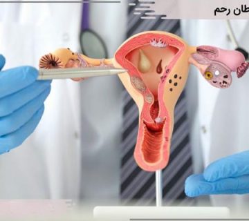 علائم سرطان رحم