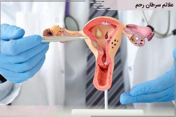 علائم سرطان رحم