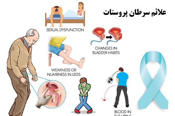 علائم سرطان پروستات