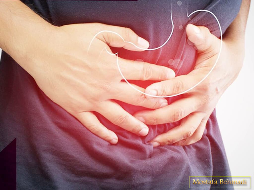 سرطان معده سرطان معده