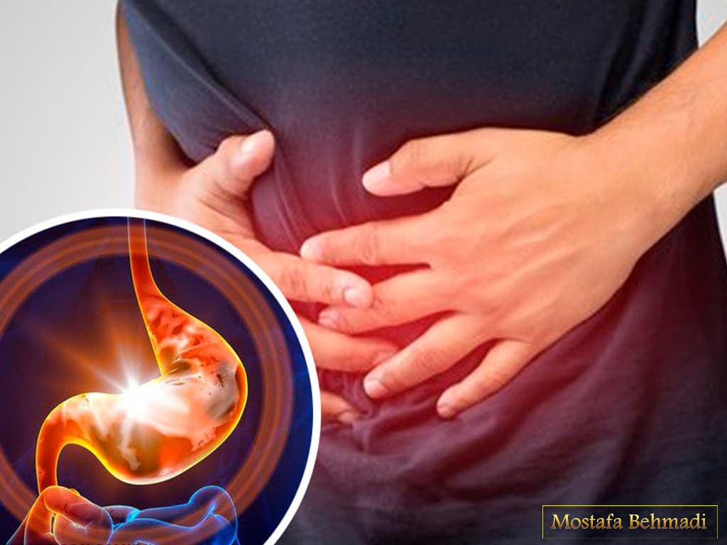 سرطان معده و علائم آن سرطان معده و علائم آن