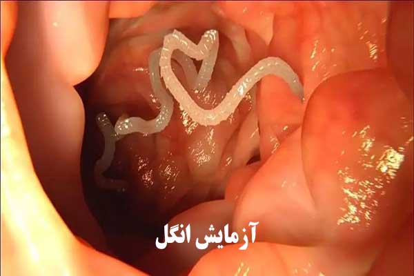 آزمایش انگل