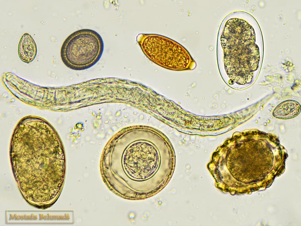 آزمایش انگل با استفاده از روش اسکاچ آزمایش انگل با استفاده از روش اسکاچ