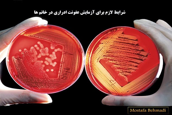 شرایط لازم برای آزمایش عفونت ادراری در خانم ها