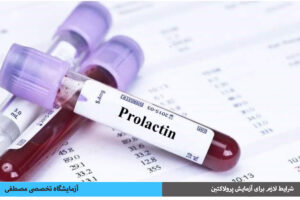 شرایط لازم برای آزمایش پرولاکتین