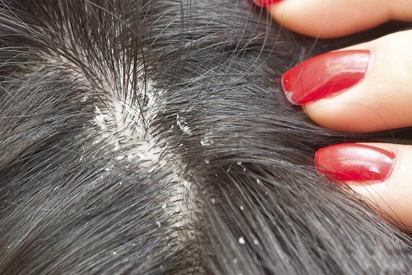 شرایط لازم برای نمونه قارچ