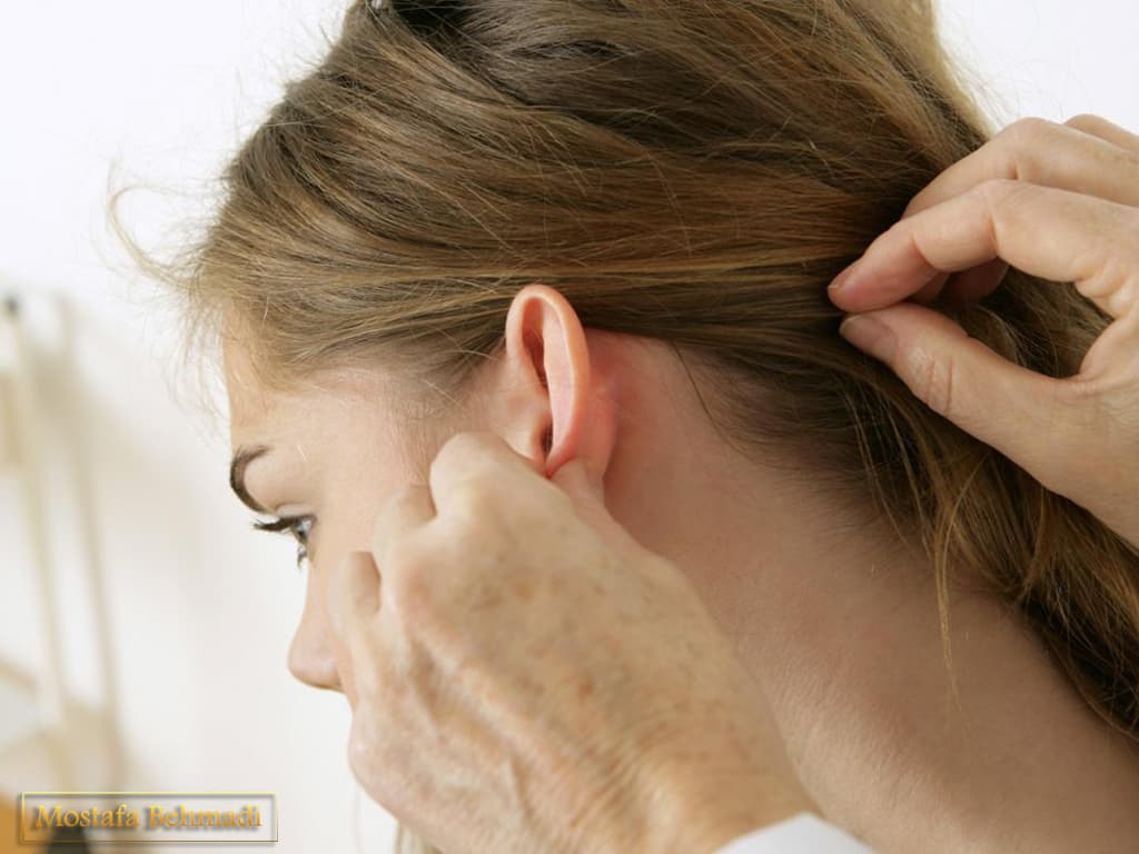 شرایط لازم برای نمونه قارچ شرایط لازم برای نمونه قارچ