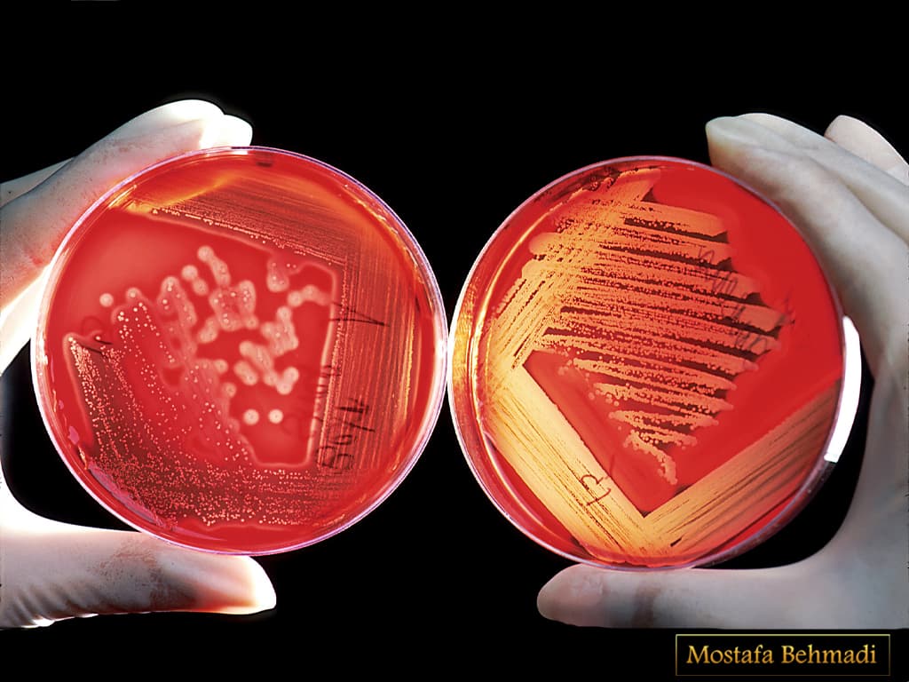 شرایط لازم برای آزمایش عفونت ادراری در خانم ها