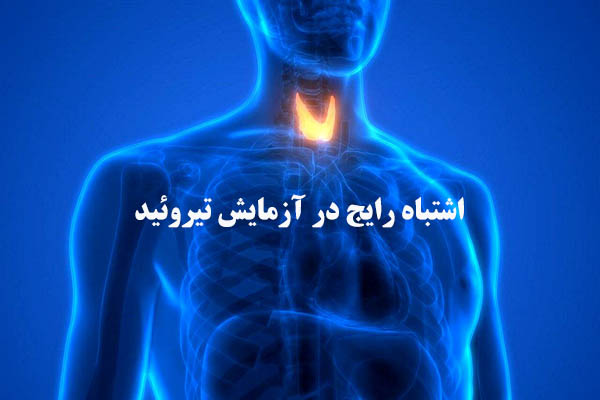 اشتباه رایج در آزمایش تیروئید