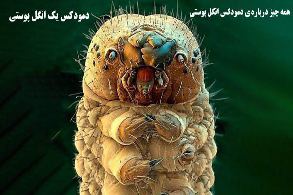 دمودکس یک انگل پوستی