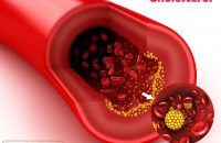 cholesterol cholesterol