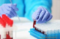 نمونه گیری در منزل نمونه گیری در منزل